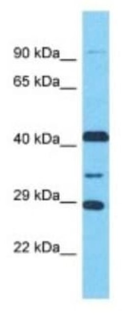 LRGUK Rabbit anti-Human, Polyclonal, Novus Biologicals 100 &mu;g | Buy Online | Novus Biologicals | Fisher Scientific